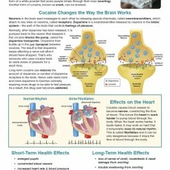 Sportime Substance Abuse And Addiction Bulletin Board Charts, Set Of 7, Grades 5 To 12 -Physical Education Resources shop 2041464 C ecommfullsize