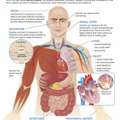 Sportime All About Opioid Drugs Bulletin Board Charts, Set Of 7, Grades 5 To 12 -Physical Education Resources shop 2041471 D ecommfullsize