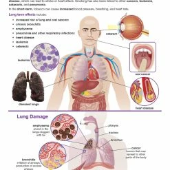 Sportime Effects Of Smoking And Vaping Bulletin Board Charts, Set Of 6, Grades 5 To 12 -Physical Education Resources shop 2041472 E ecommfullsize