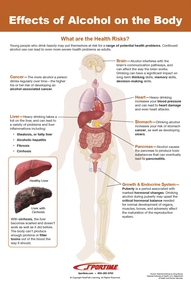 Sportime Alcohol Abuse And Addiction Bulletin Board Charts, Set Of 7, Grades 5 To 12 6 Sportime Alcohol Abuse And Addiction Bulletin Board Charts, Set Of 7, Grades 5 To 12 - Image 4