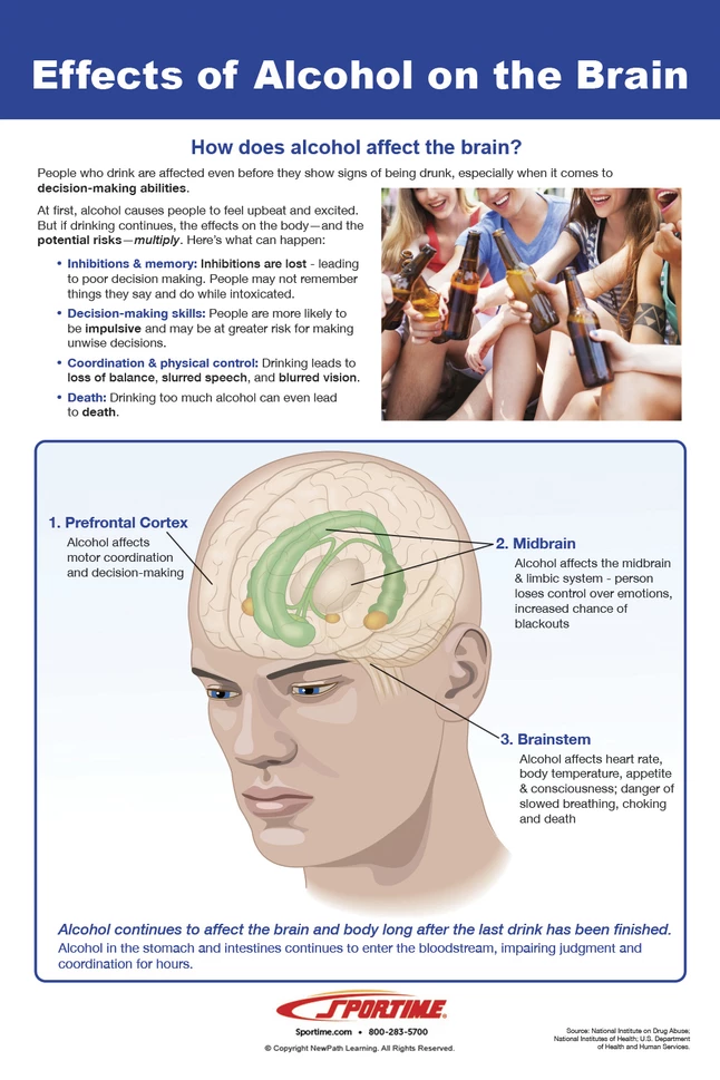 Sportime Impaired Driving Bulletin Board Charts, Set Of 8, Grades 5 To 12 6 Sportime Impaired Driving Bulletin Board Charts, Set Of 8, Grades 5 To 12 - Image 4
