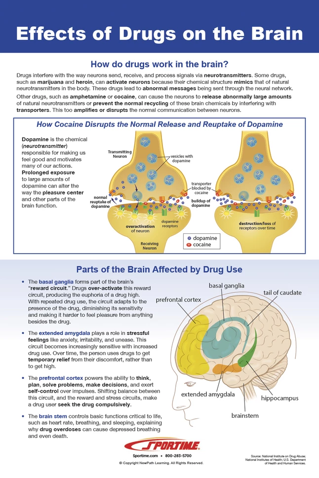 Sportime Impaired Driving Bulletin Board Charts, Set Of 8, Grades 5 To 12 7 Sportime Impaired Driving Bulletin Board Charts, Set Of 8, Grades 5 To 12 - Image 5